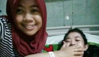 korban penyiraman air keras