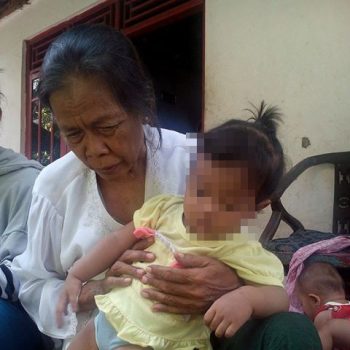 rinanti penderita gagal jantung bawaan