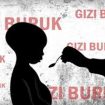 gizi buruk