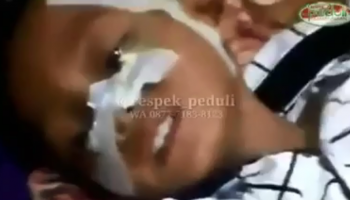 butuh bantuan operasi