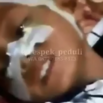 butuh bantuan operasi
