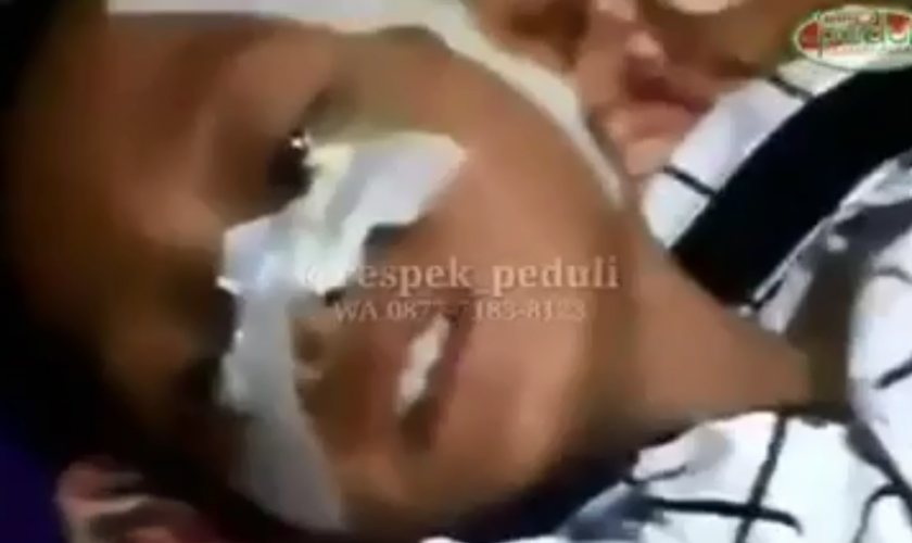 butuh bantuan operasi