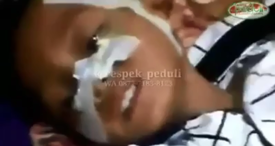 butuh bantuan operasi